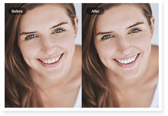 Free Teeth Whitening App